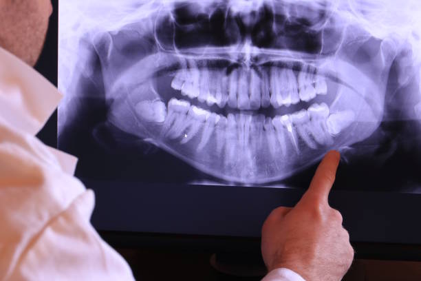 Best Tooth Infection Emergency Dentist  in Coson, OK